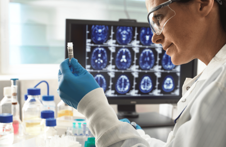 Lab scientist looking at a vial, in background computer screen with brain scans.