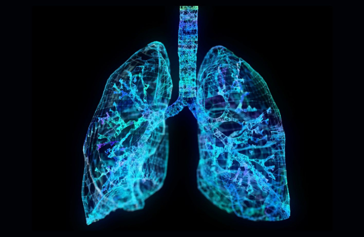 Image of lungs