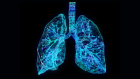 image of lungs